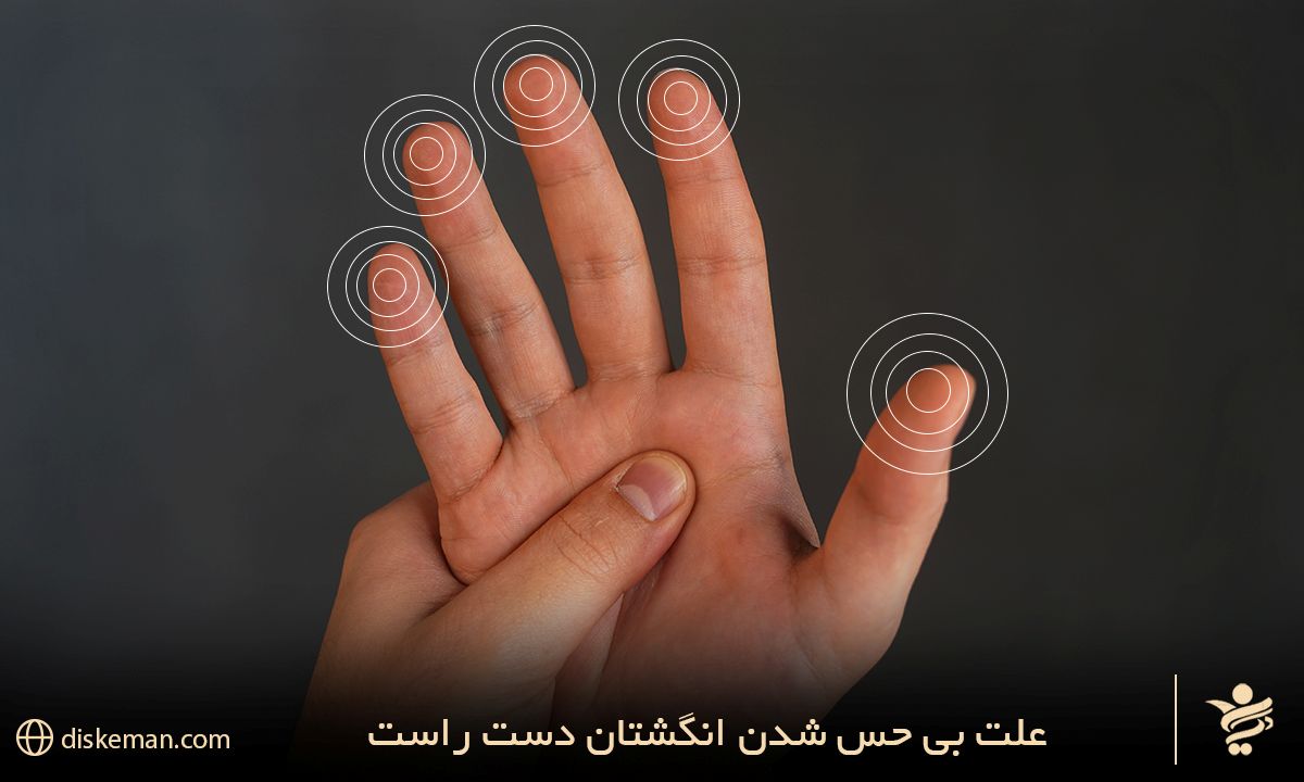 علت بی حس شدن انگشتان دست راست