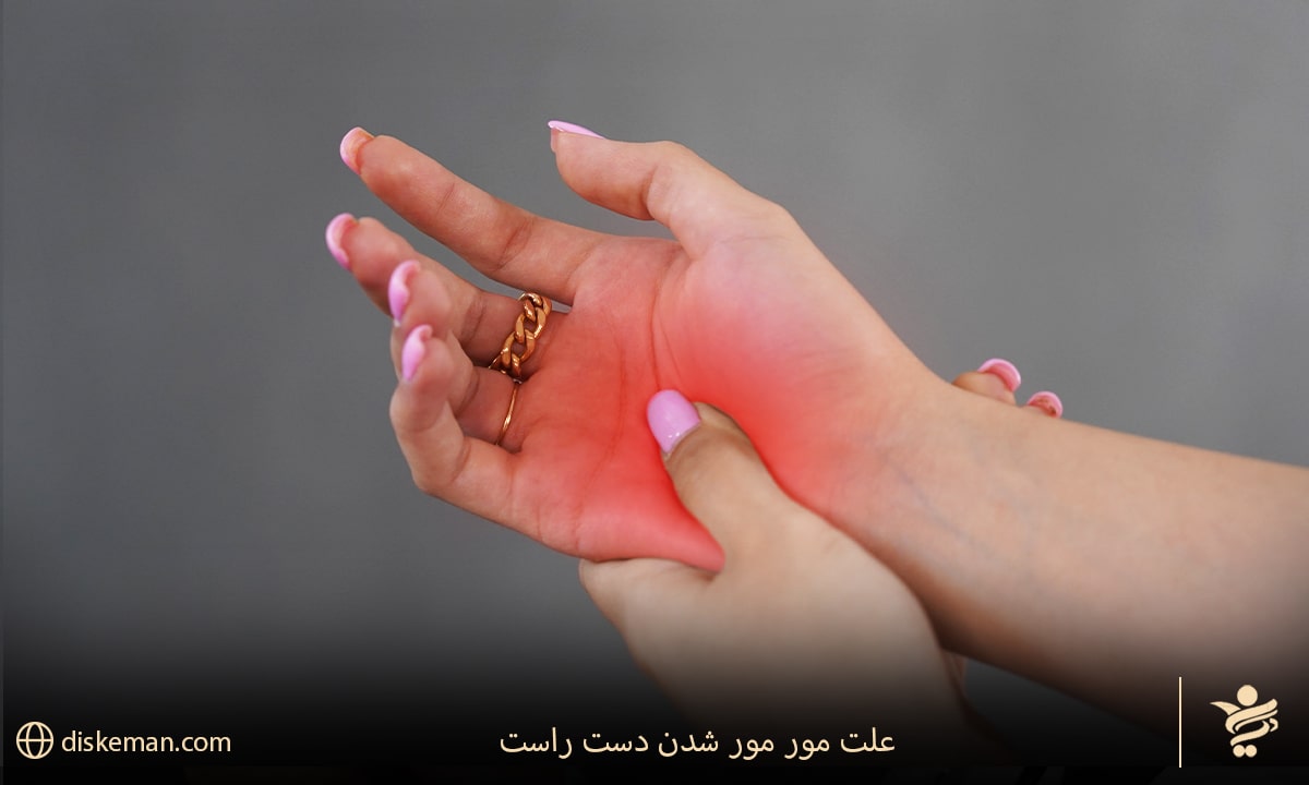 علت مور مور شدن دست راست