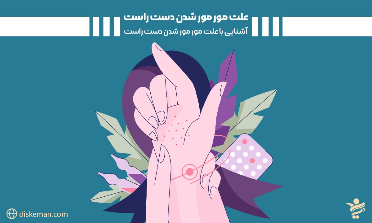 علت مور مور شدن دست راست