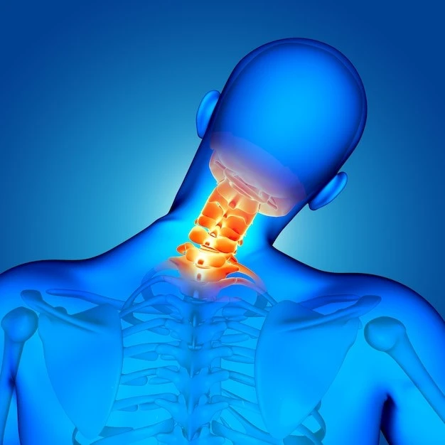 Treatment-disc-neck-arthritis