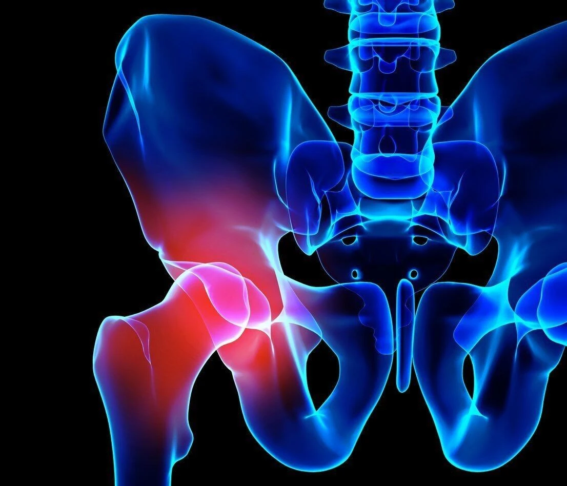 hip-joint-pain